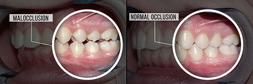 Gregory J. Schmitt, DMD | Teeth Whitening, Dental Bridges and Veneers