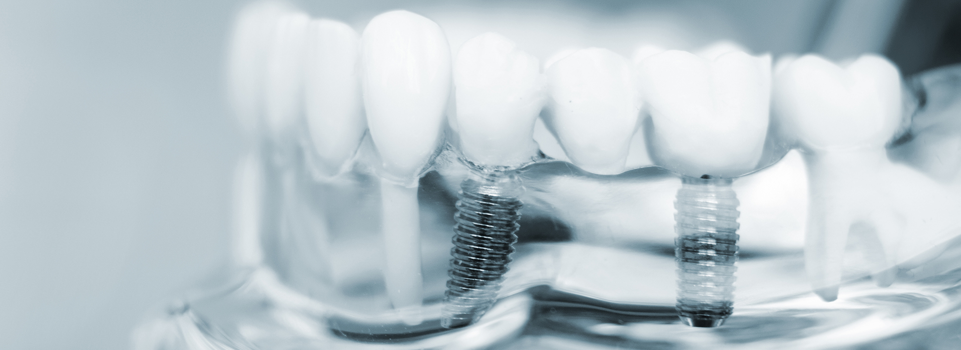Gregory J. Schmitt, DMD | Snoring Appliances, Root Canals and Crowns  amp  Caps